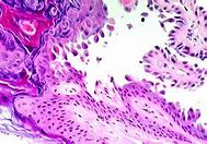 Image result for acantoc�fwlo