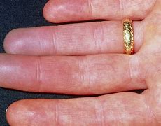 Image result for Knuckles Turning White