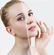 Image result for Anti-Aging Face