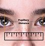 Image result for Narrow Pupillary Distance