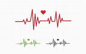 Image result for cardiograma