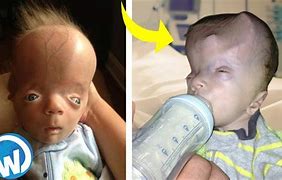 Image result for Weird Babies