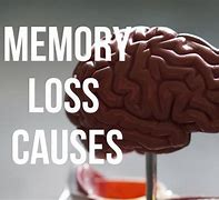 Image result for Medicine for Memory Loss