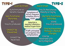 Image result for Differentiate Type 1 and Type 2 Diabetes