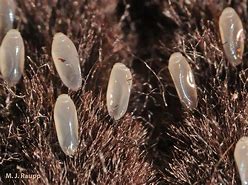 Image result for What Do Lice Eggs Look Like