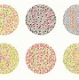 Image result for All Types of Color Blindness