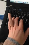 Image result for Human Extra Fingers