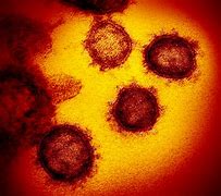 Image result for Samy Worm Virus