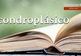 Image result for acondropl�dico