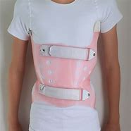 Image result for New Back Brace for Scoliosis