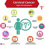 Image result for Cervical Cancer Signs and Symptons