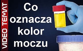 Image result for co_oznacza_Żółty_tydzień