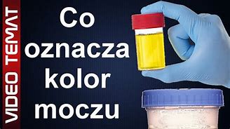 Image result for co_to_znaczy_zastój_Żółci