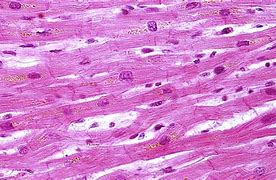 Image result for cardiac muscle