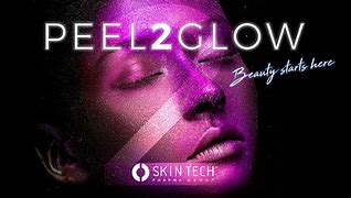 Image result for Peel 2 Glow