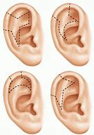 Image result for Outer Ear Flap