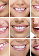 Image result for 3 Smile Types