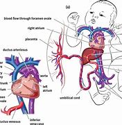 Image result for Neonatal Circulation