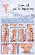 Image result for Diagram of Cervical Spine