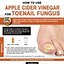 Image result for Apple Cider Vinegar and Nail Fungus