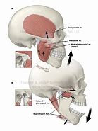 Image result for Human Upper Jaw