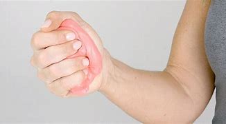 Image result for Hand Exercises for Stroke Patients