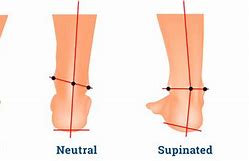 Image result for Pronation vs Supination Feet