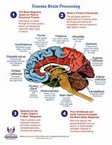 Image result for Parts of Trauama Brain