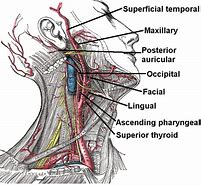 Image result for Where Are the Carotid Arteries