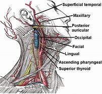 Image result for Common Carotid Arteries