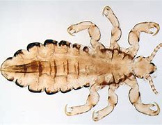 Image result for c�lice