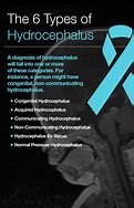 Image result for Different Types of Hydrocephalus