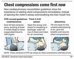 Image result for How to Do Chest Compressions