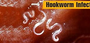 Image result for Crow Can Hook Worm