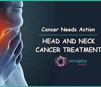 Image result for Head and Neck Cancer