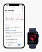 Image result for Series 6 Apple Watch ECG