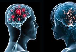 Image result for Neurosyphilis