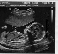 Image result for Ultrasound Side Profile