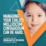 Image result for Molluscum vs Warts