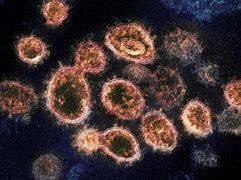 Image result for Covid Virus Under Microscope