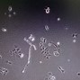 Image result for Hek 293 Cells