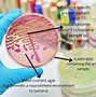 Image result for UTI Urine Culture