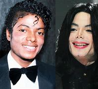 Image result for Michael Jackson Before and After Fire