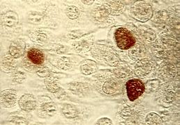 Image result for Chlamydia Pneumoniae