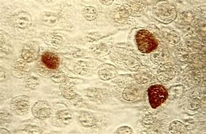 Image result for Chlamydia Bacteria Under Microscope
