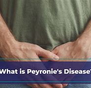 Image result for What Does Peronies Condition Look Like