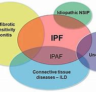 Image result for IPAF Ild