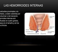 Image result for hemoreoide