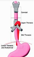 Image result for Esophagus Drawing