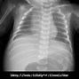 Image result for Samsung X-ray Portable